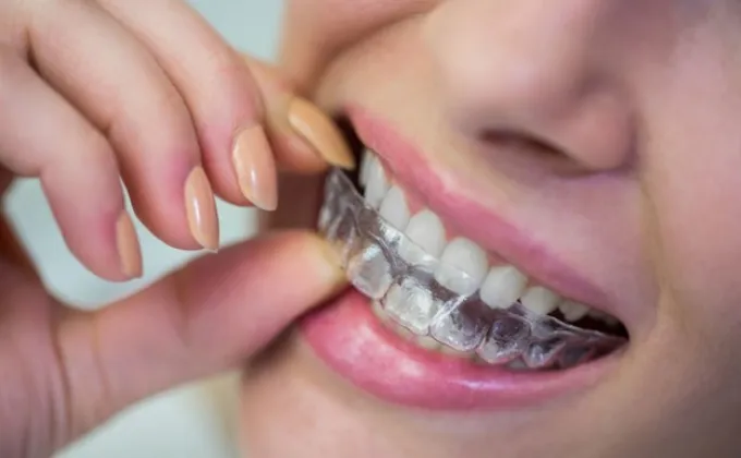 วิธีหาโปรจัดฟันแบบ clear aligner