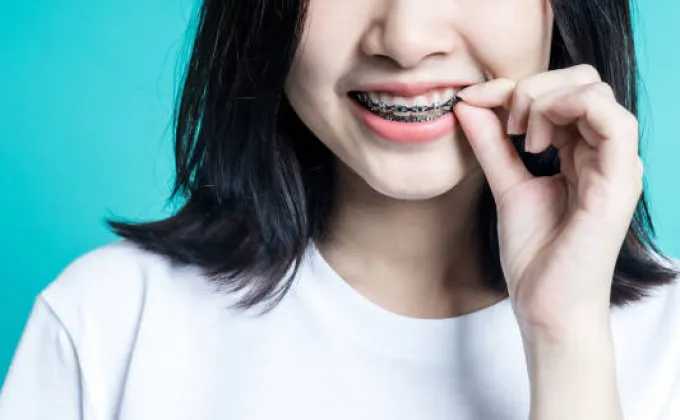 จัดฟันที่ไหนดี? บอกปัจจัยพิจารณาเลือกคลินิกที่เหมาะสม