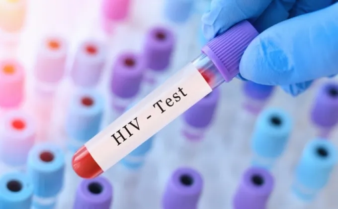 รู้เท่าทันเชื้อ HIV – HIV (Human Immunodeficiency Virus)