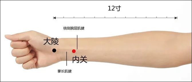 ไขข้อข้องใจ !How to การเลือกใช้ปลอกข้อมือ โดย คลินิกการแพทย์แผนจีนหัวเฉียว